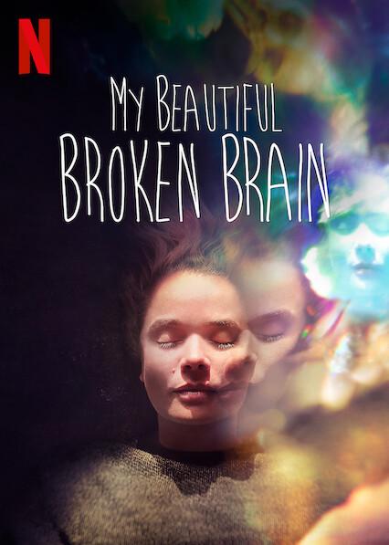 My Beautiful Broken Brain