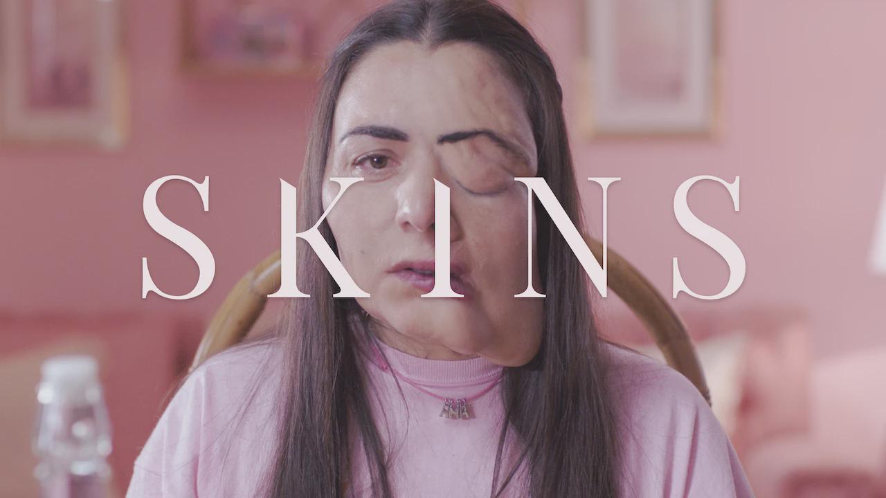 Skins